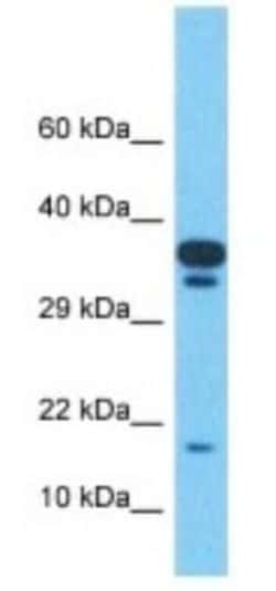 TMEM220 Rabbit anti-Human, Polyclonal, Novus Biologicals:Antibodies:Primary